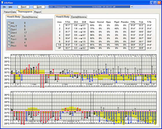 GUI Example